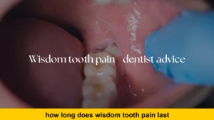 how long does wisdom tooth pain last