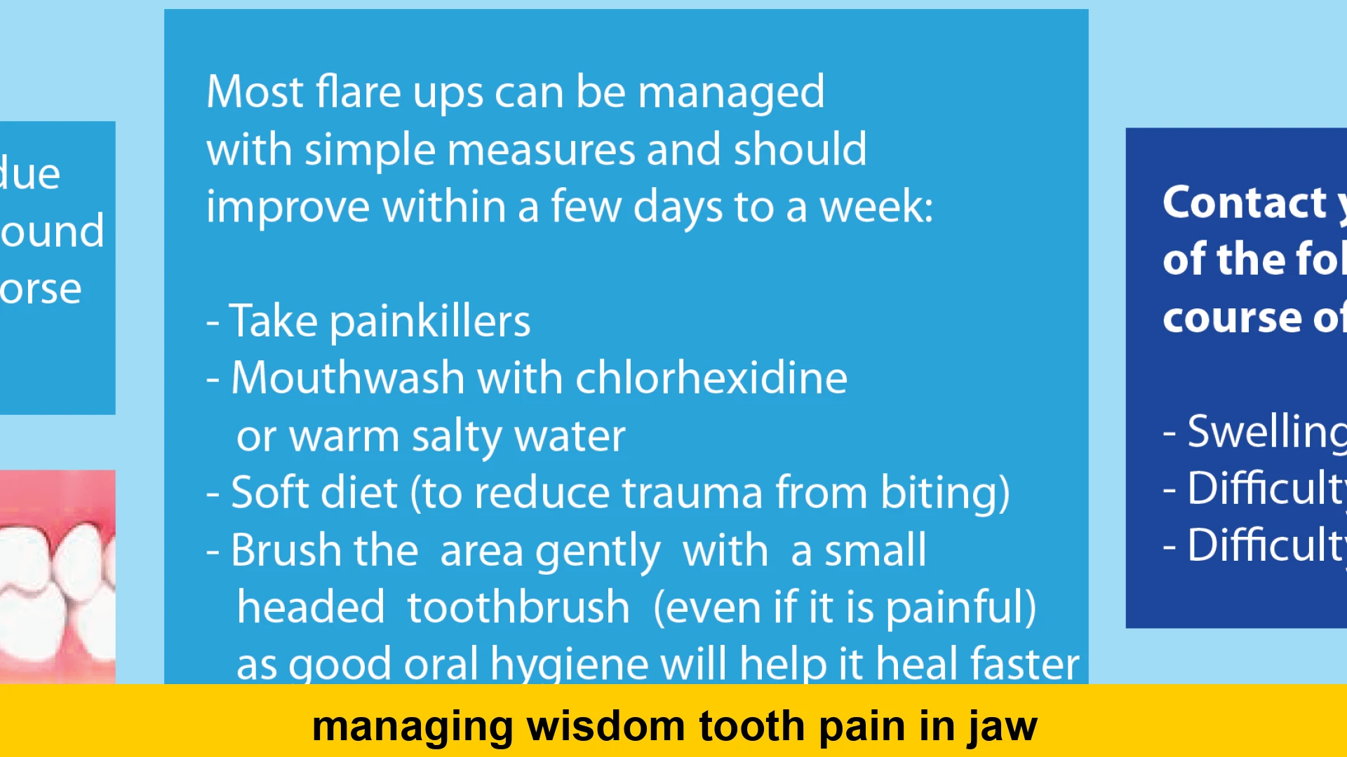 managing wisdom tooth pain in jaw