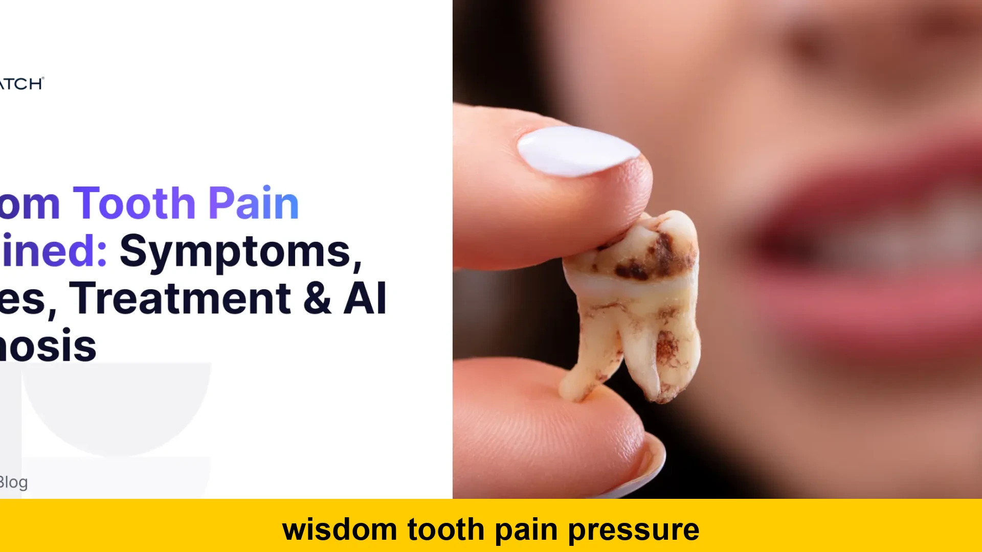 wisdom tooth pain pressure
